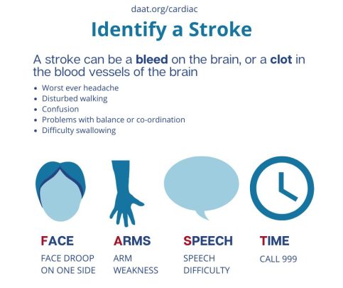 Identify a stroke