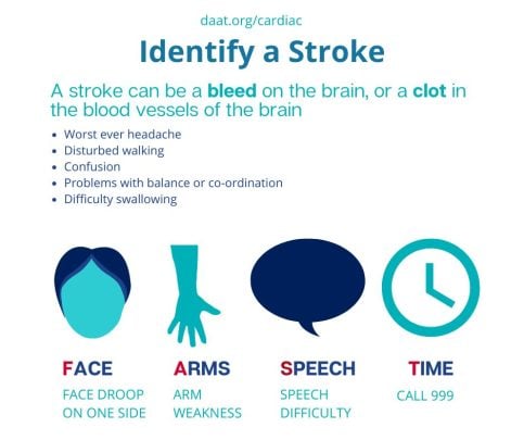 Identify a stroke